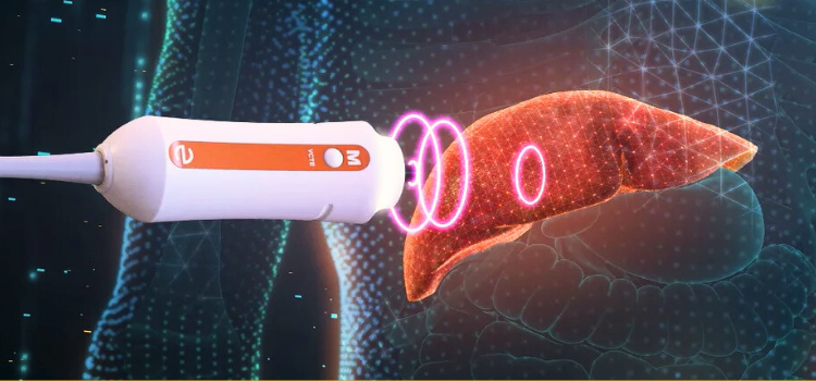 Nuovo FibroScan® al Centro Polisalute di Cinisello Balsamo: esame epatico rapido e indolore